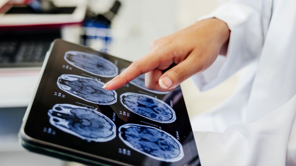 Dr. Michael Ziffra, a psychiatrist at Northwestern Medicine, told the AP that people's attention spans are "similar to a muscle."